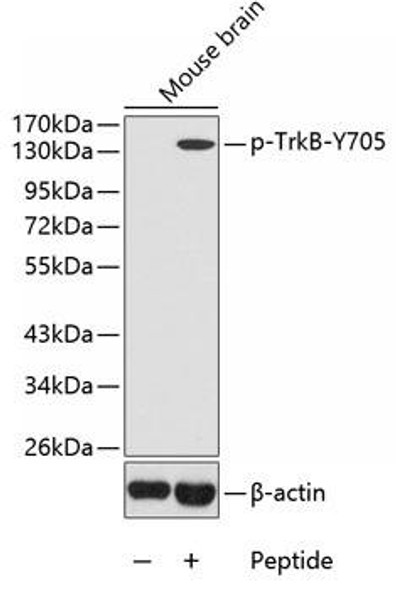 Anti-Phospho-NTRK2-Y705 Antibody (CABP0423)