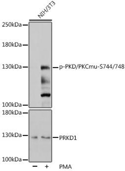 Anti-Phospho-PKD/PKCmu-S744/748 Antibody (CABP0534)