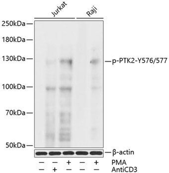 Anti-Phospho-PTK2-Y576/577 Antibody (CABP0536)