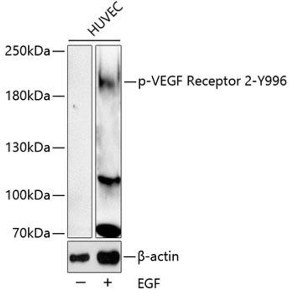 Anti-Phospho-VEGFR2-Y996 Antibody (CABP0595)