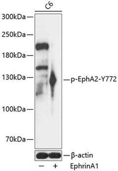 Anti-Phospho-EphA2-Y772 pAb Antibody (CABP0817)