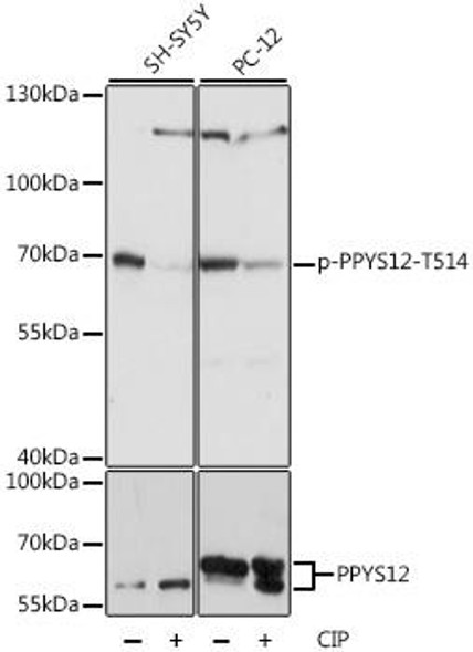 Anti-Phospho-DPYSL2-T514 pAb Antibody (CABP0821)