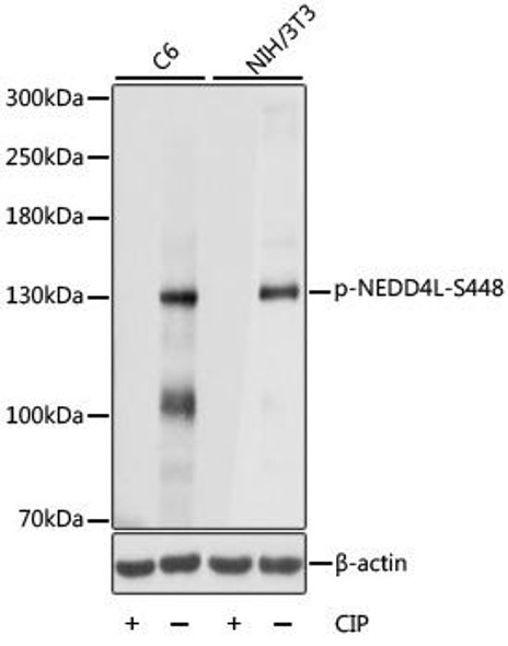 Anti-Phospho-NEDD4L-S448 pAb Antibody (CABP0843)