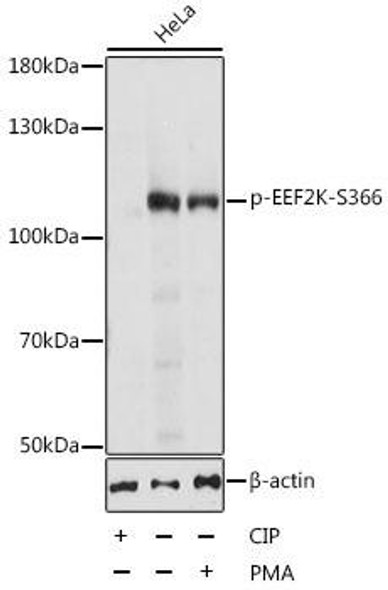 Anti-Phospho-EEF2K-S366 pAb Antibody (CABP0845)