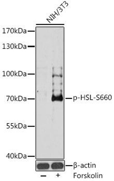 Anti-Phospho-LIPE-S660 pAb Antibody (CABP0853)