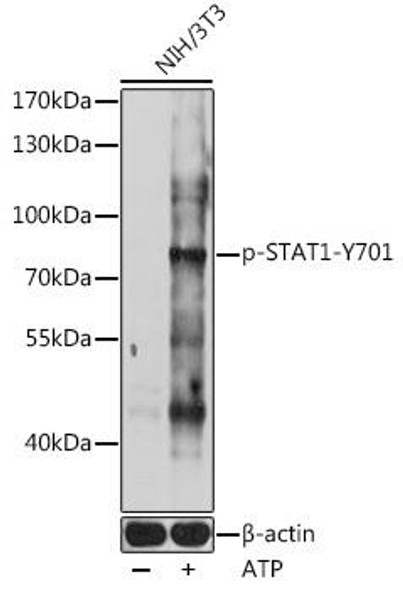 Anti-Phospho-STAT1-Y701 pAb Antibody (CABP0858)