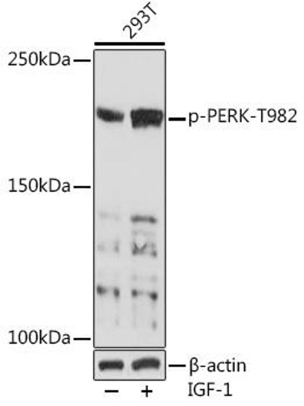 Anti-Phospho-PERK-T982 pAb Antibody (CABP0886)