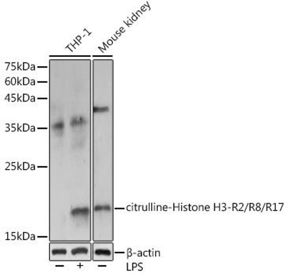 Anti-citrulline-Histone H3-R2/R8/R17 Antibody (CAB18298)