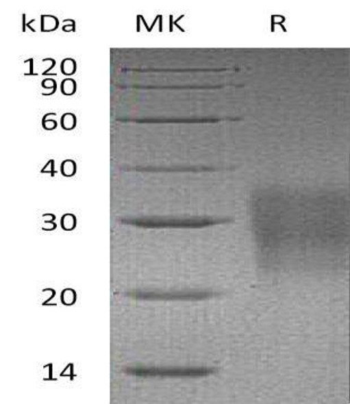 Mouse FAS/TNFRSF6 Recombinant Protein (RPES0092)