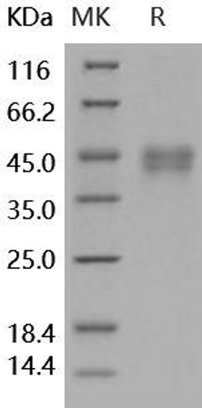 Human DKK1/Dkk Recombinant Protein (RPES0094)