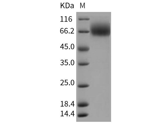 Rat TrkB/NTRK2 Recombinant Protein (RPES0133)