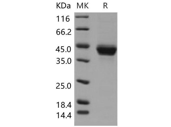 Mouse CD23 Recombinant Protein (RPES0134)