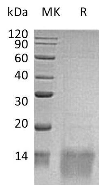 Human GDF11/BMP1 Recombinant Protein (RPES0139)