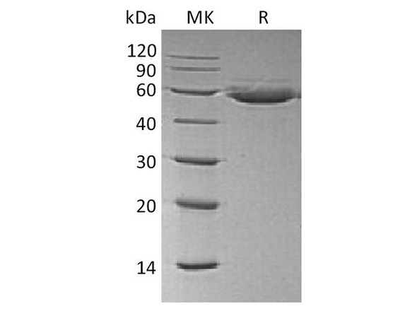 Human CTLA4 Recombinant Protein (RPES0149)