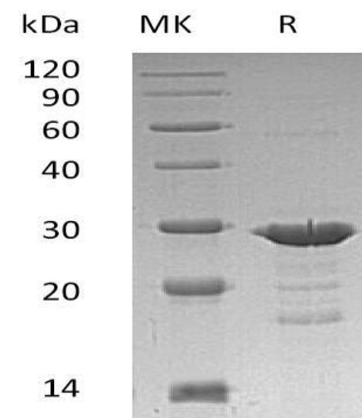 Human GRB2 Recombinant Protein (RPES0160)