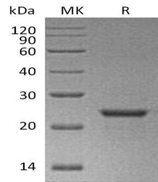 Human NEDD8 Recombinant Protein (RPES0161)