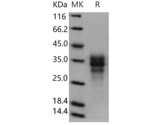 Human Fas/CD95/TNFRSF6 Recombinant Protein (RPES0175)