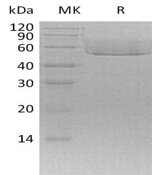 Mouse CX3CL1/Fractalkine Recombinant Protein (RPES0185)