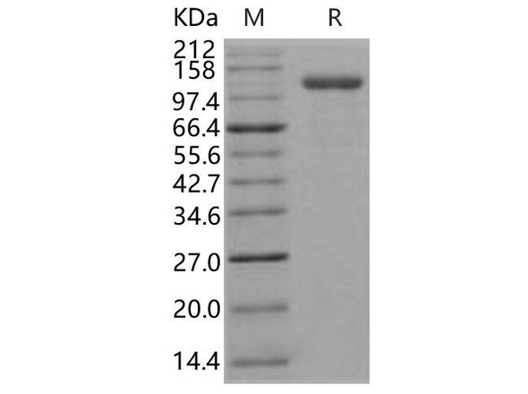 Human Endoglin/CD105 Recombinant Protein (RPES0199)