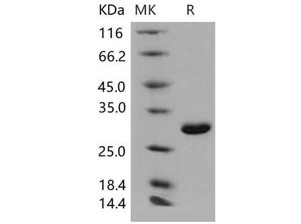 Mouse UCHL1/PGP9.5 Recombinant Protein (RPES0216)