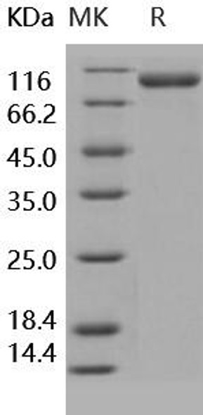 Human CD31/PECAM1 Recombinant Protein (RPES0218)