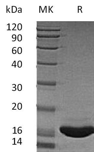 Human SCF/c-Kit Ligand Recombinant Protein  (RPES0222)