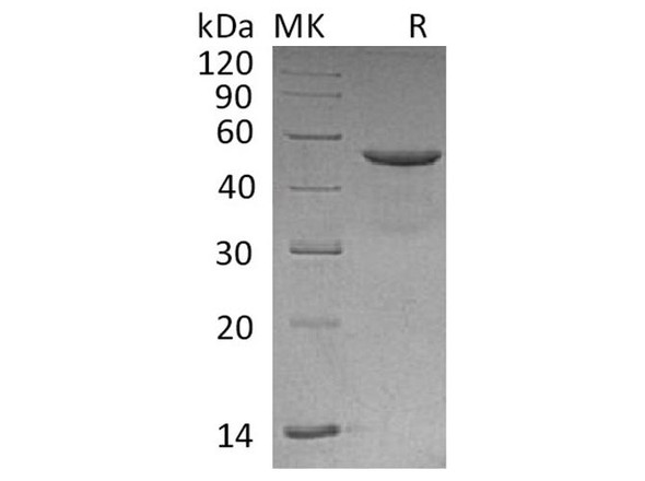 Human CD99/MIC2 Recombinant Protein (RPES0238)