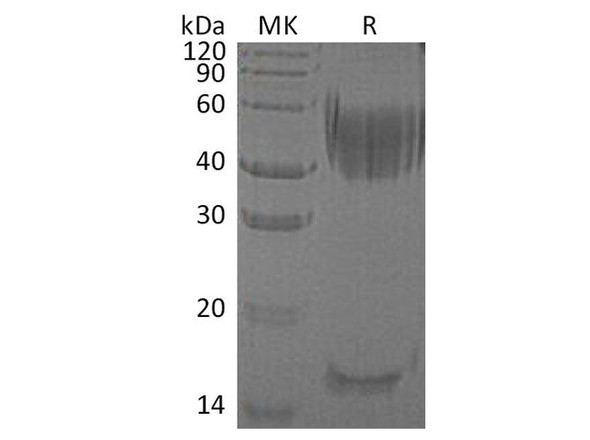 Human Haptoglobin/Zonulin Recombinant Protein (RPES0239)