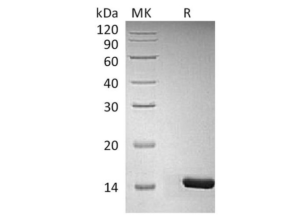 Human/Mouse/Rat BDNF Recombinant Protein  (RPES0247)