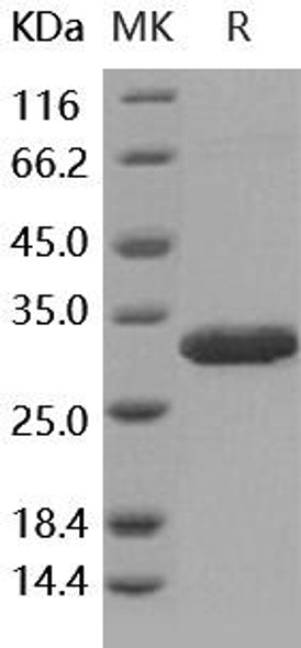 Human Latexin/LXN Recombinant Protein (RPES0251)