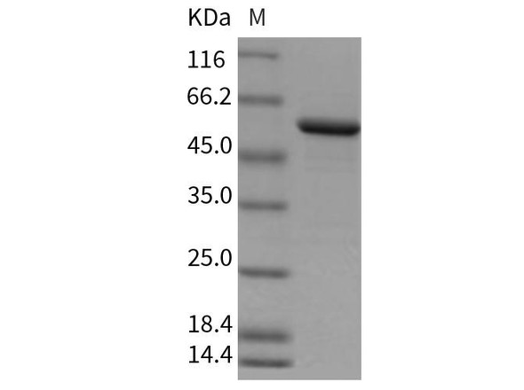 Rat Galectin-8/LGALS8 Recombinant Protein (RPES0252)