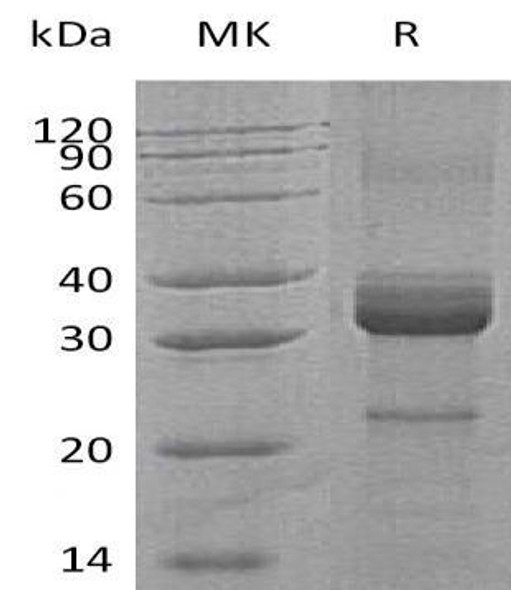 Human Pre-Haptoglobin-2/Zonulin Recombinant Protein (RPES0258)