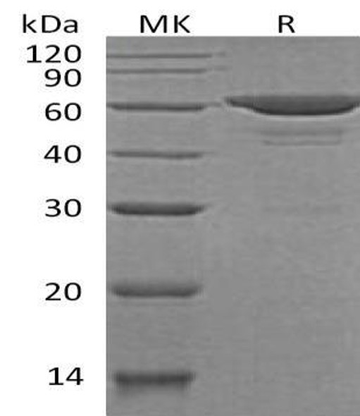 Human SOAT2/ACAT2 Recombinant Protein (RPES0260)