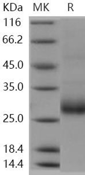 Human RANKL/TNFSF11 Recombinant Protein  (RPES0269)