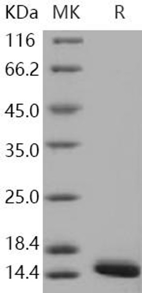 Human FABP4/A-FABP Recombinant Protein (RPES0314)