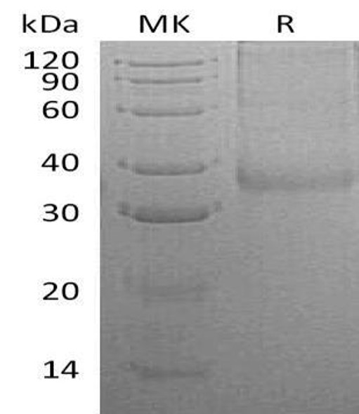 Human CHRNB3 Recombinant Protein (RPES0318)