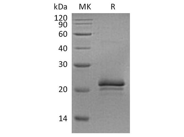 Rat VEGF-A/VEGF164 Recombinant Protein (RPES0320)