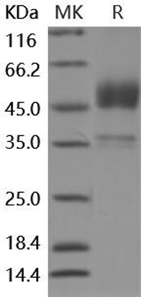 Mouse BMPR1B/ALK-6 Recombinant Protein (RPES0333)