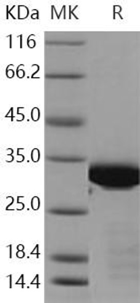 BCL6/B-cell CLL lymphoma 6 Recombinant Protein (RPES0334)