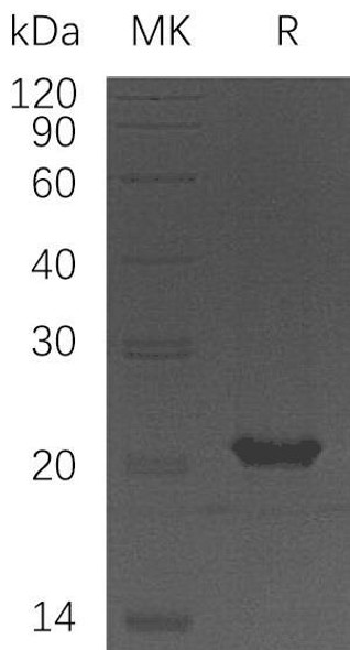 Human HSPB11 Recombinant Protein (RPES0337)