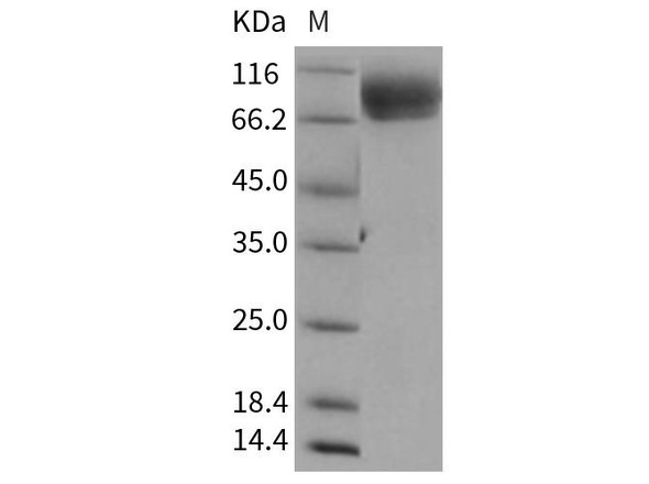 Rat ALCAM/CD166 Recombinant Protein (RPES0351)