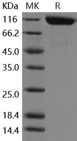 Mouse ANPEP/APN/CD13 Recombinant Protein (RPES0353)