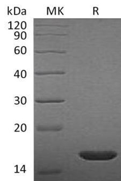 Rat FGF-2/FGFb Recombinant Protein  (RPES0360)
