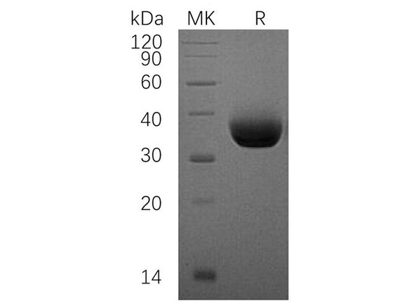 Human PD-L1/B7-H1/CD274 Recombinant Protein (RPES0364)