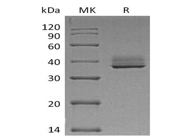 Mouse TNFRSF17/BCMA Recombinant Protein (RPES0365)