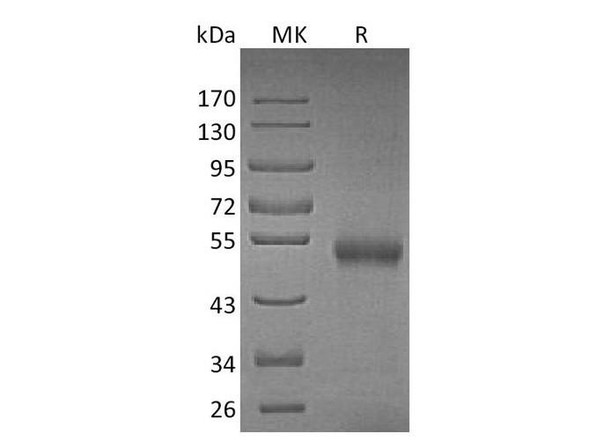Mouse Osteoprotegerin Recombinant Protein (RPES0382)