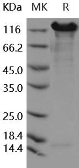 Human E-Cadherin/CDH1 Recombinant Protein (RPES0387)