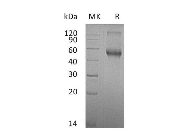 Mouse ALK/ACVRL1 Recombinant Protein (RPES0440)