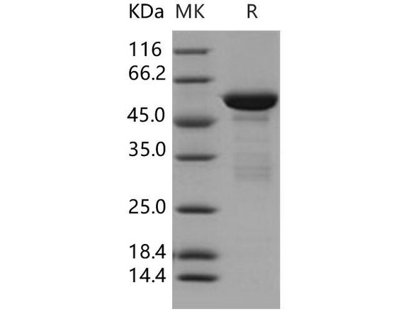 14-3-3 tau/14-3-3 theta/YWHAQ Recombinant Protein (RPES0445)