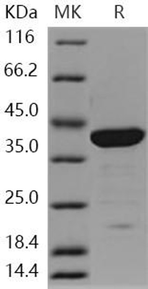 Human Galectin-7/LGALS7 Recombinant Protein (RPES0450)